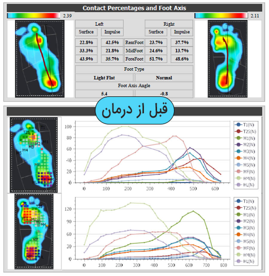 foot-scan-befor