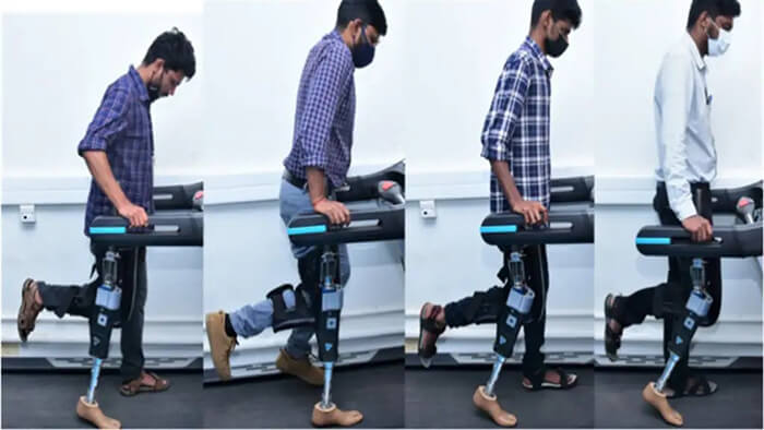 راه رفتن با پای مصنوعی هوشمند