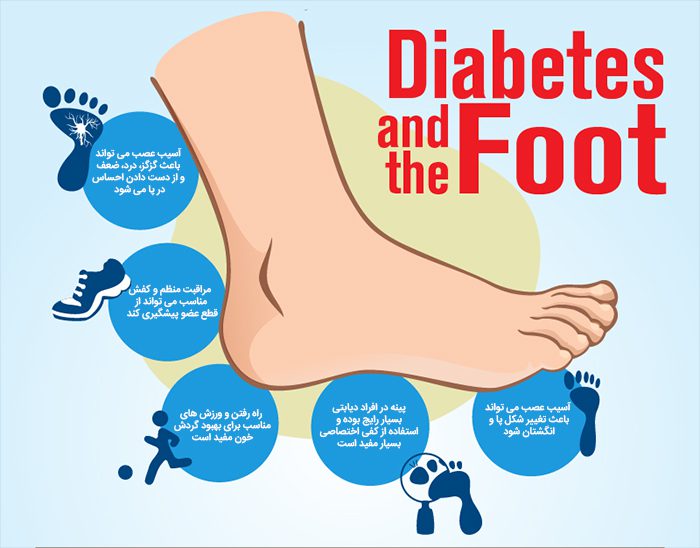 رفع مشکلات دیابتی با ساخت کفش دیابتی در مشهد