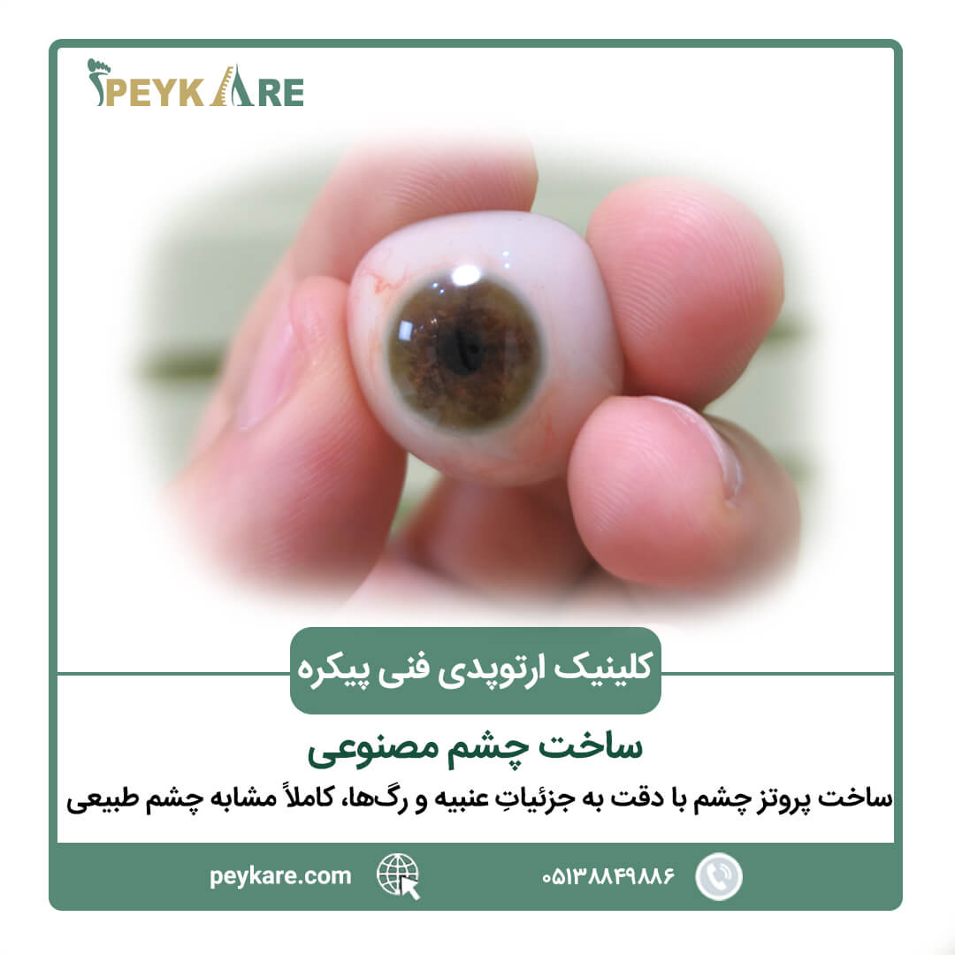 ساخت چشم مصنوعی اکریلیک