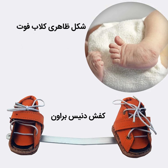 کفش دنیس براون