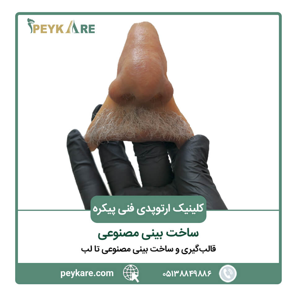 ساخت بینی مصنوعی در کلینیک پیکره مشهد